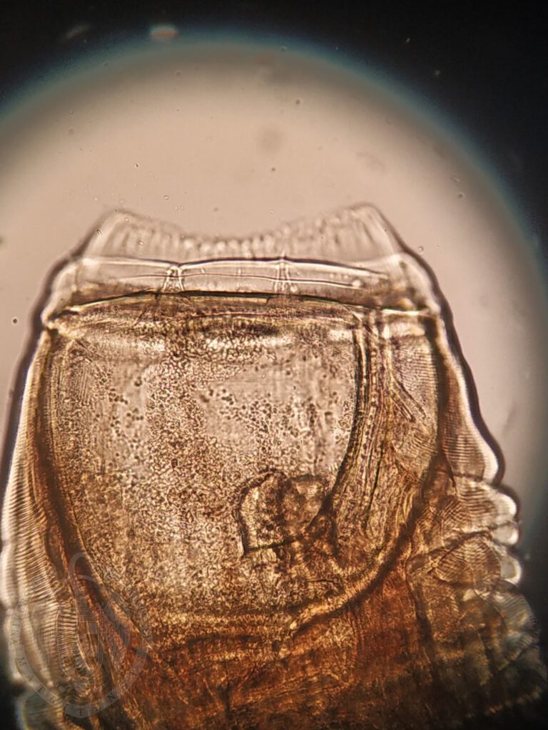 Strongylus vulgaris